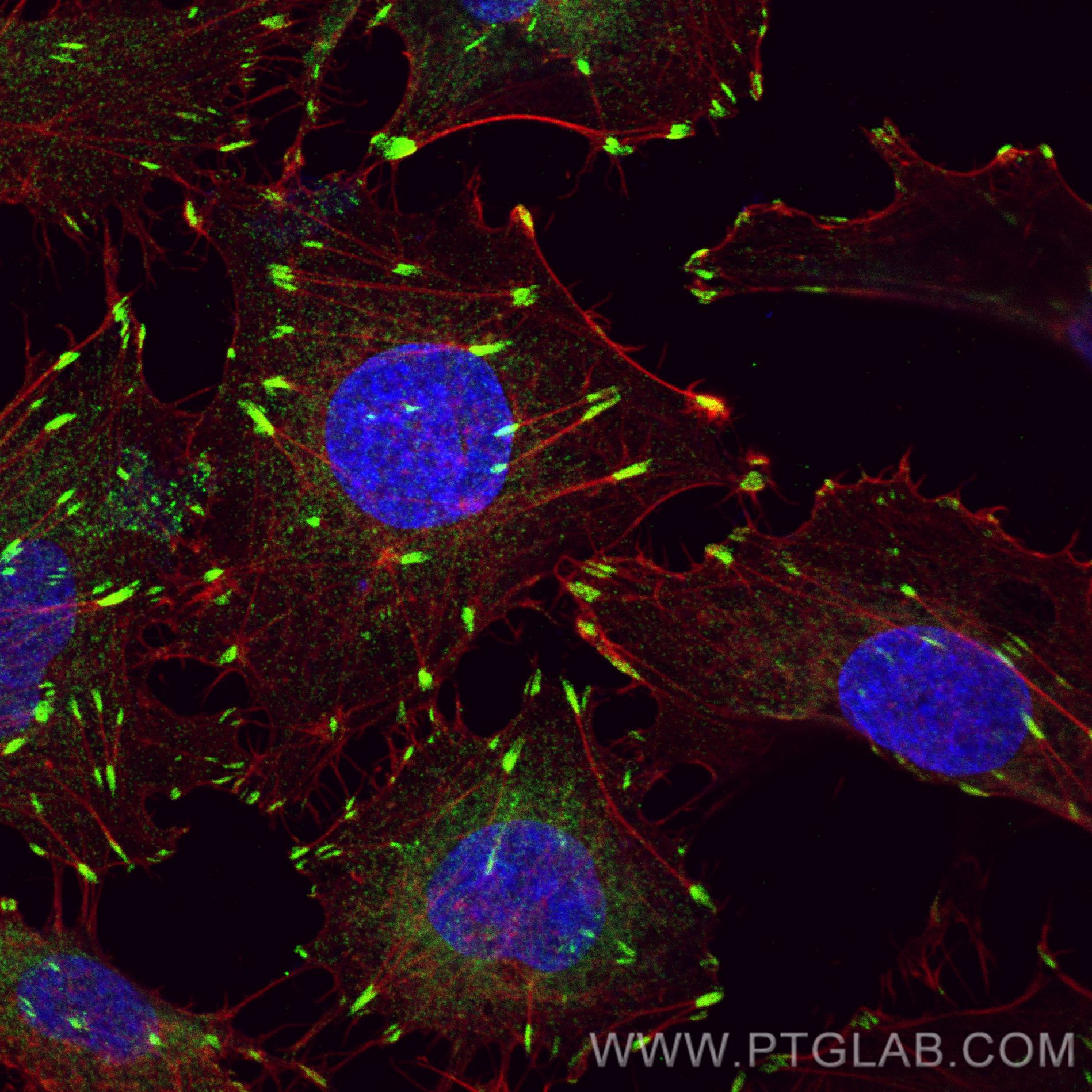 Immunofluorescence (IF) / fluorescent staining of HUVEC cells using FAK Monoclonal antibody (66258-1-Ig)