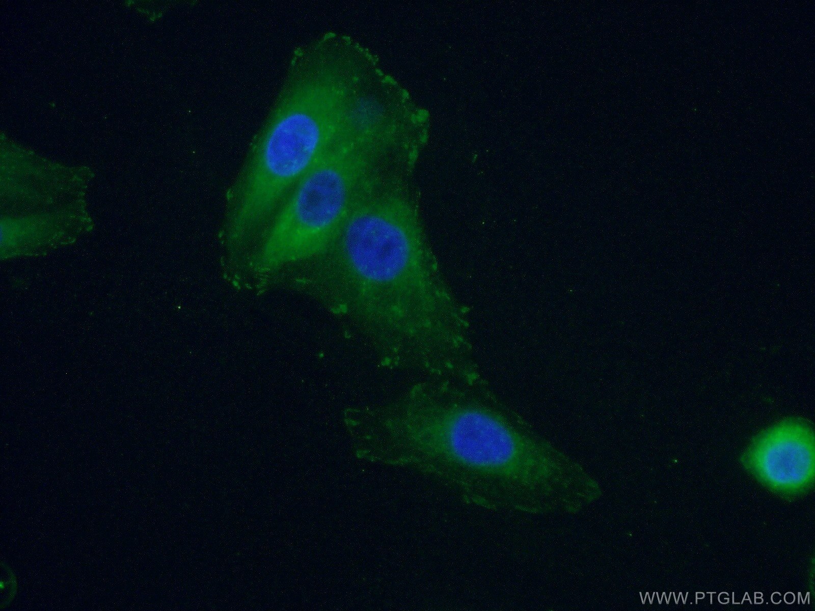 FAK Monoclonal antibody