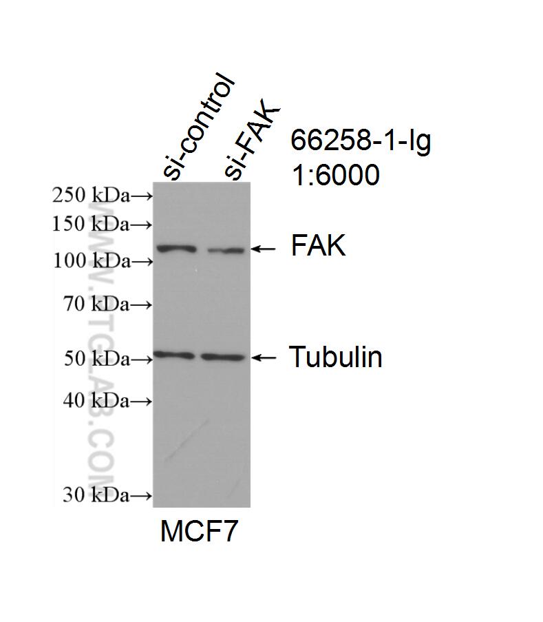 Western Blot (WB) analysis of MCF-7 cells using FAK Monoclonal antibody (66258-1-Ig)