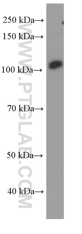 FAK Monoclonal antibody