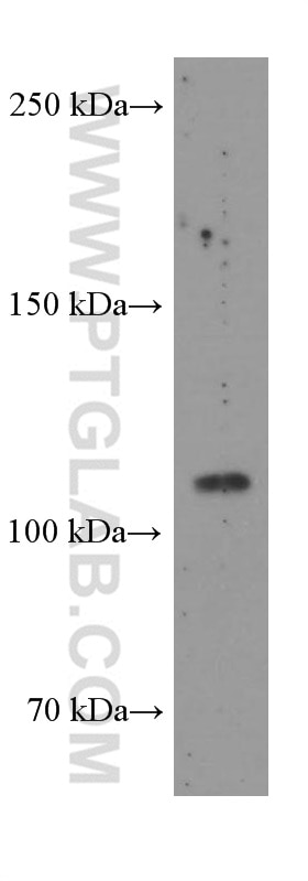 Western Blot (WB) analysis of human testis tissue using FAK Monoclonal antibody (66258-1-Ig)