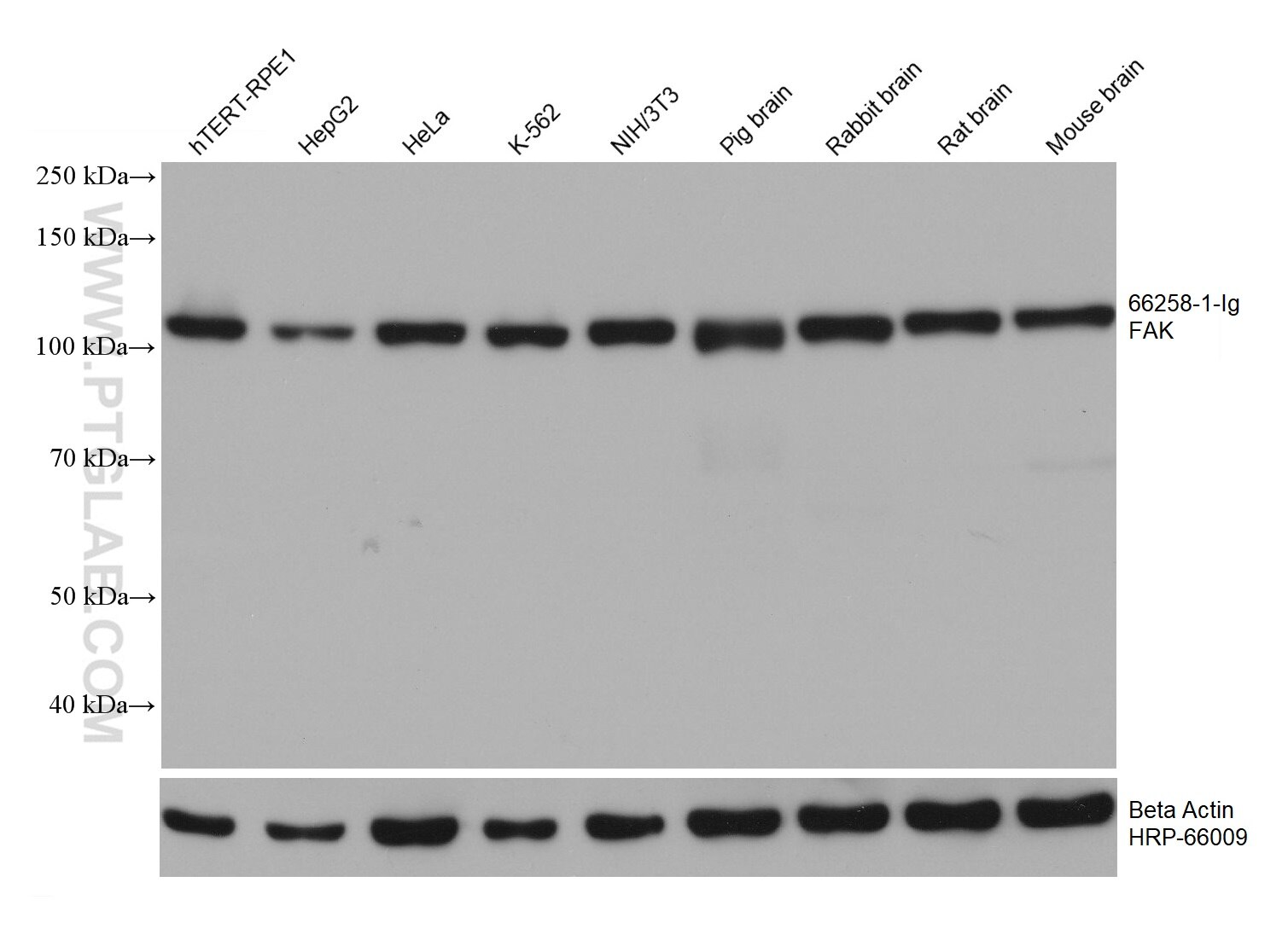 Western Blot (WB) analysis of various lysates using FAK Monoclonal antibody (66258-1-Ig)