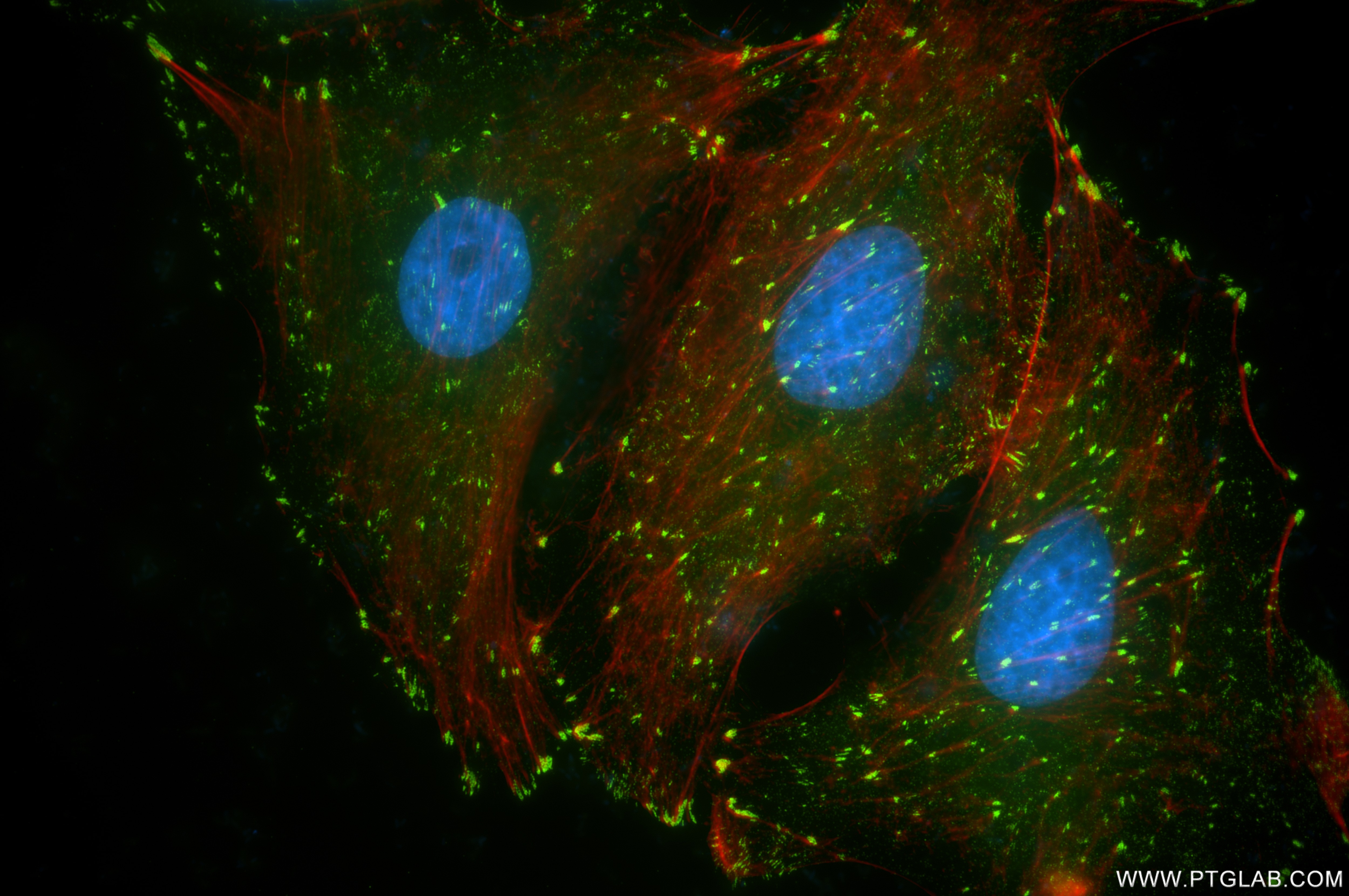 Immunofluorescence (IF) / fluorescent staining of A549 cells using FAK Recombinant antibody (81334-5-RR)