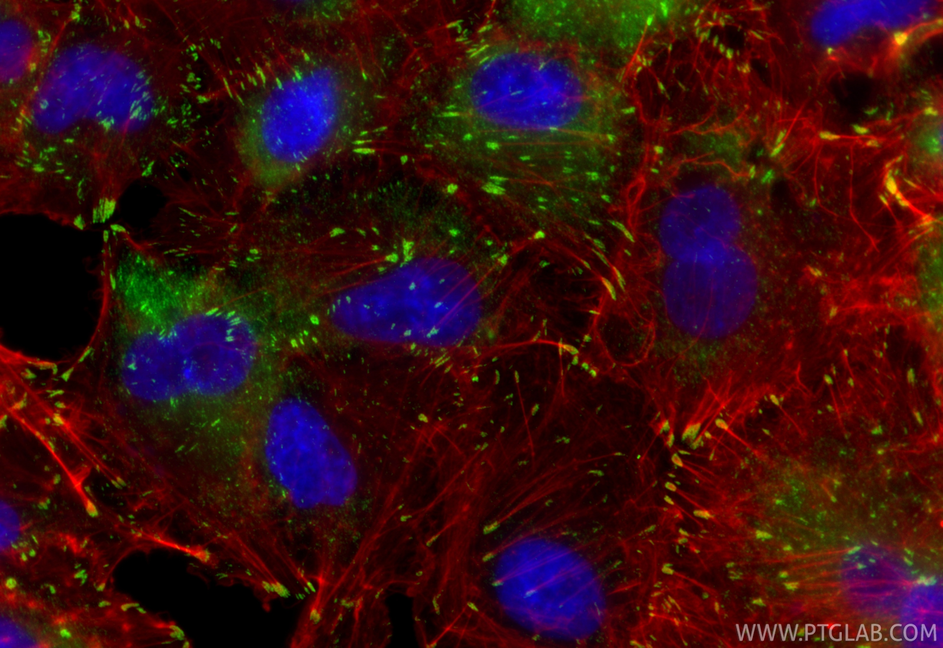 Immunofluorescent analysis of (4% PFA) fixed A549 cells using FAK antibody (81334-5-RR, Clone: 242295E4 ) at dilution of 1:1000 and CoraLite®488-Conjugated Goat Anti-Rabbit IgG(H+L) (SA00013-2), CL594-Phalloidin (red). Immunofluorescence (IF) / fluorescent staining of A549 cells using FAK Recombinant monoclonal antibody (81334-5-RR)