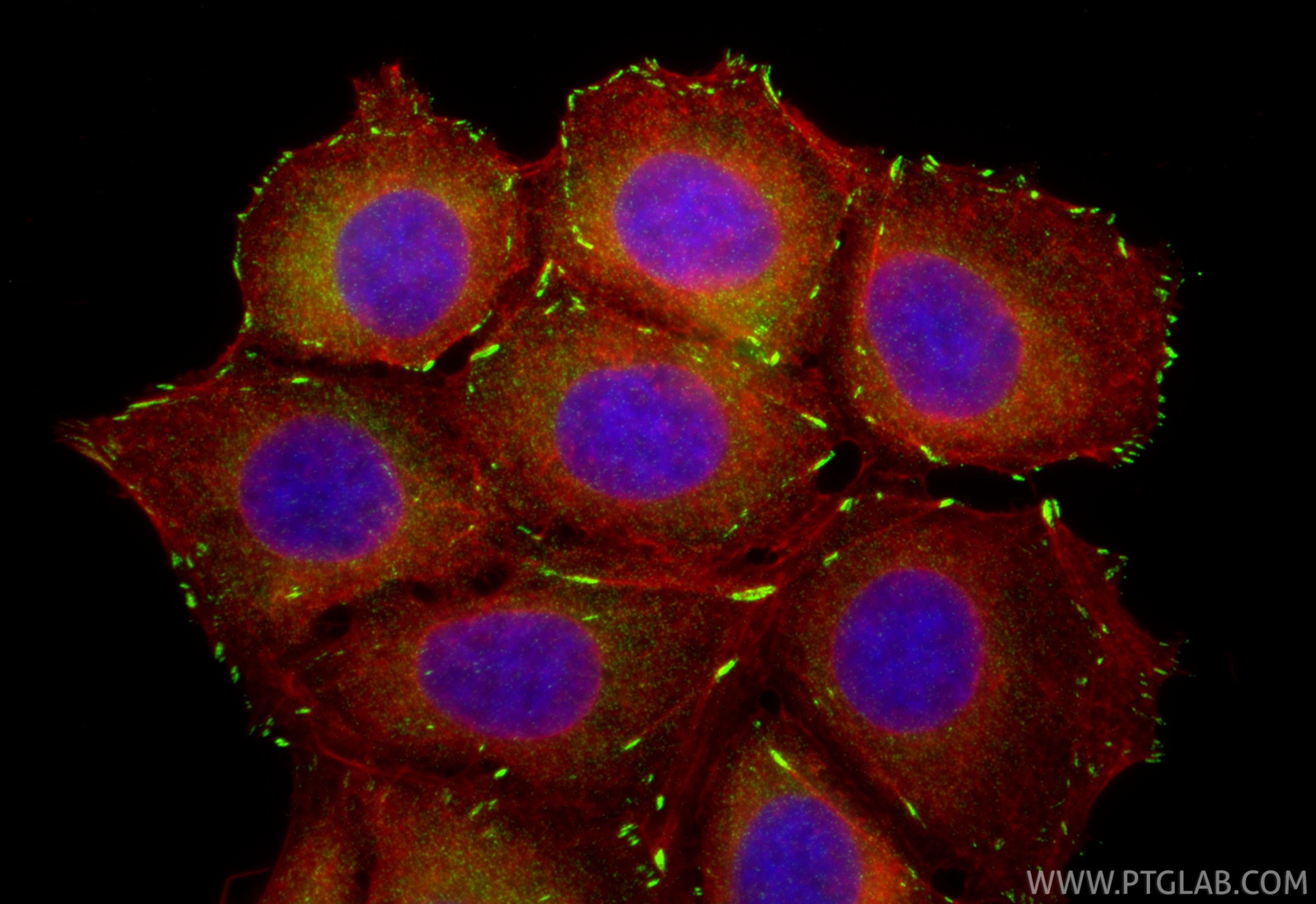 Immunofluorescent analysis of (4% PFA) fixed MCF-7 cells using FAK antibody (81334-5-RR, Clone: 242295E4 ) at dilution of 1:1000 and CoraLite®488-Conjugated Goat Anti-Rabbit IgG(H+L) (SA00013-2), CL594-Phalloidin (red). Immunofluorescence (IF) / fluorescent staining of MCF-7 cells using FAK Recombinant monoclonal antibody (81334-5-RR)