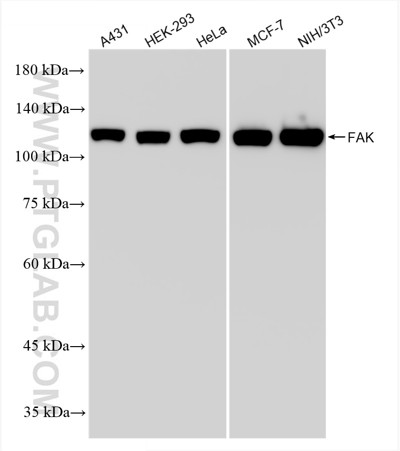 Western Blot (WB) analysis of various lysates using FAK Recombinant antibody (81334-5-RR)