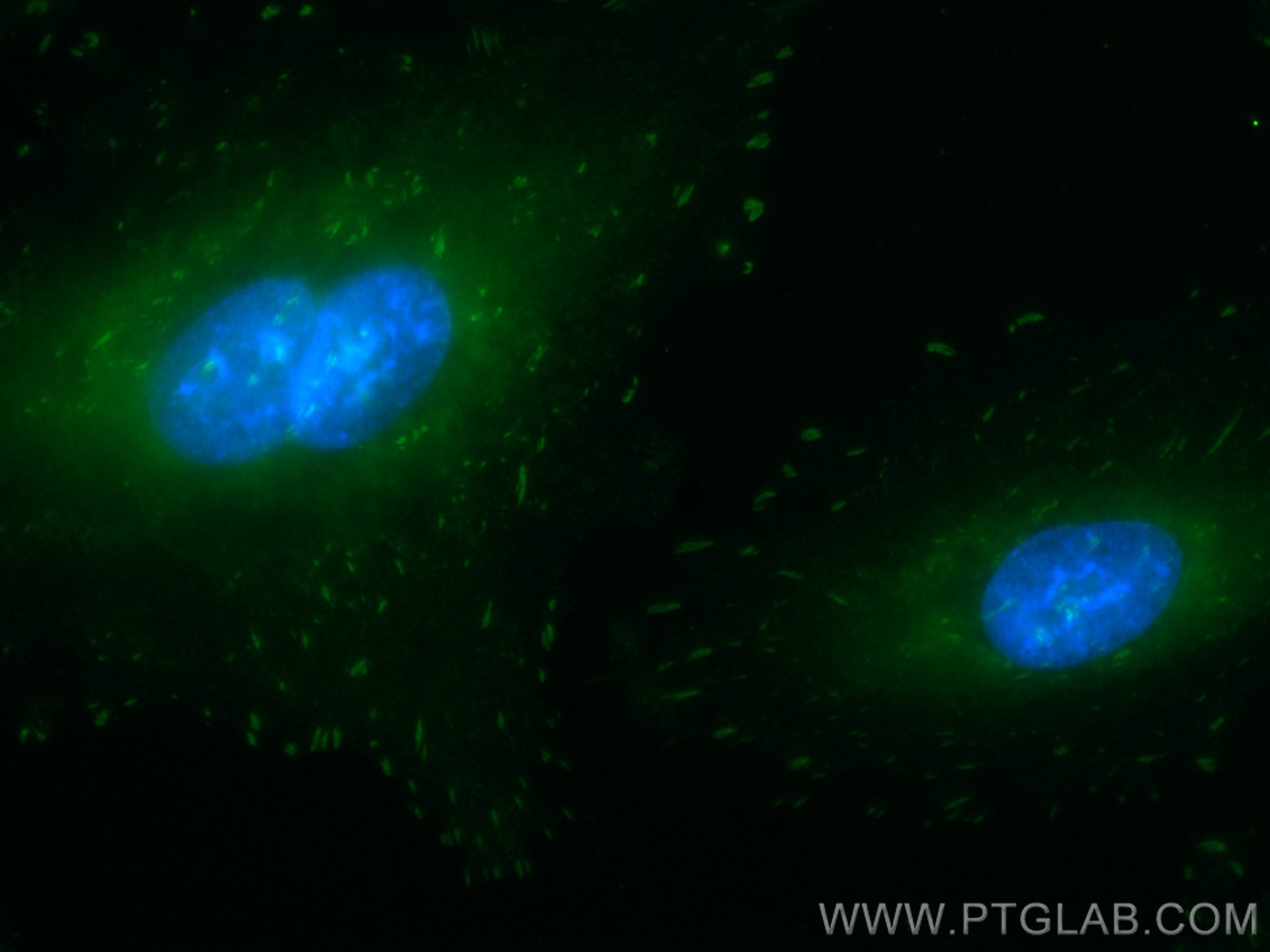 Immunofluorescence (IF) / fluorescent staining of A549 cells using CoraLite® Plus 488-conjugated FAK Monoclonal antib (CL488-66258)