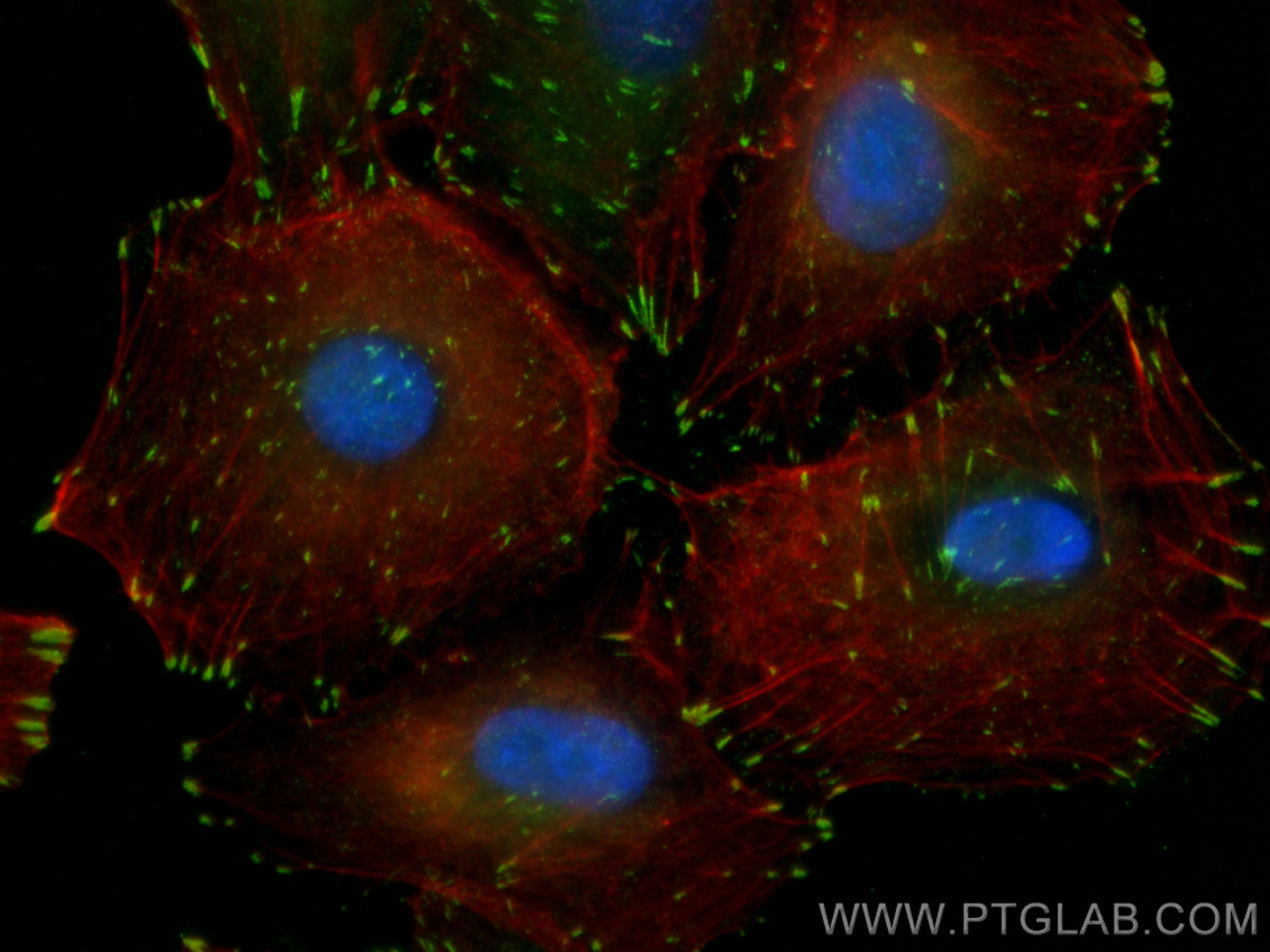 Immunofluorescence (IF) / fluorescent staining of A549 cells using CoraLite® Plus 488-conjugated FAK Monoclonal antib (CL488-66258)