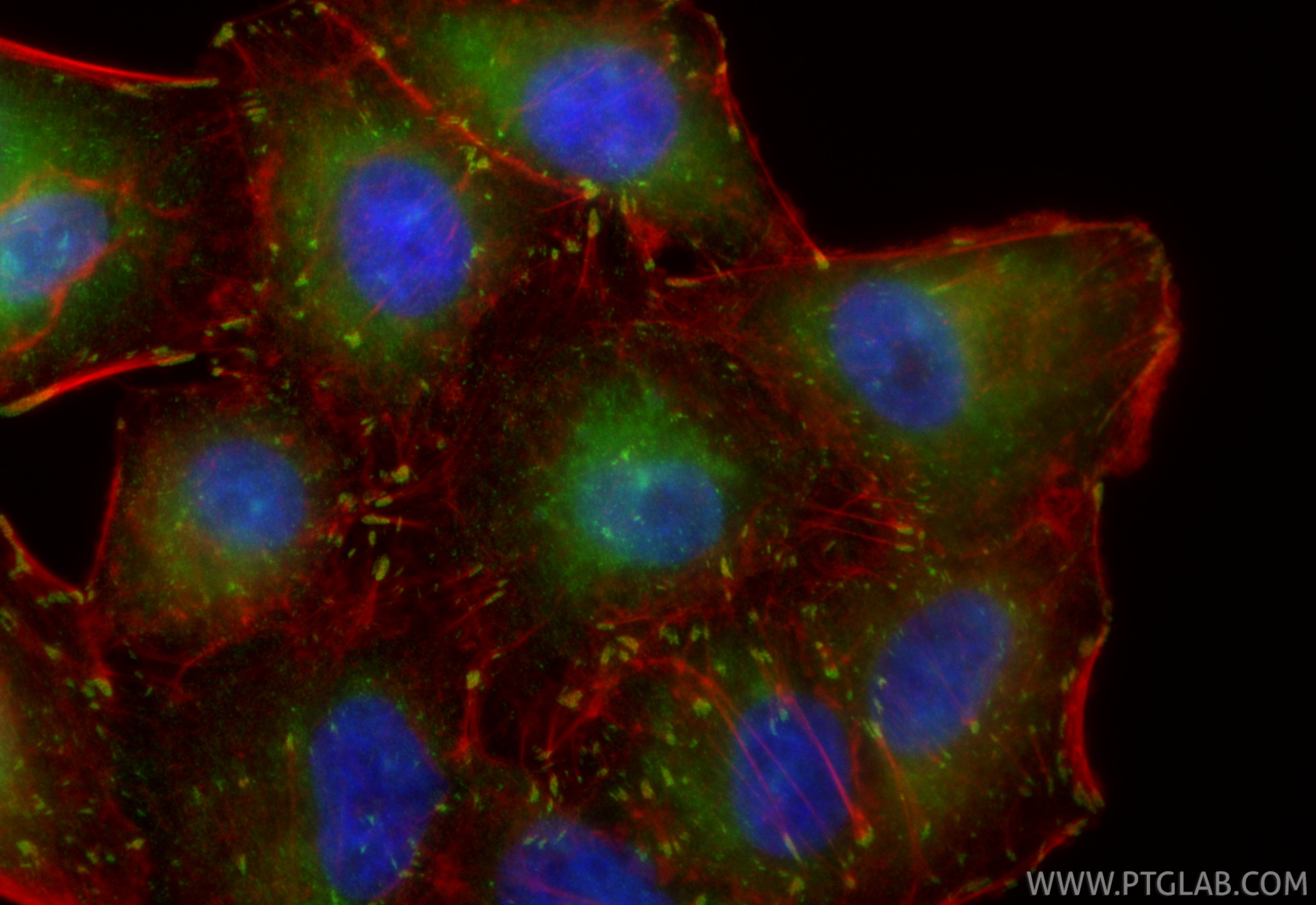 Immunofluorescent analysis of (4% PFA) fixed A549 cells using CoraLite® Plus 488 FAK antibody (CL488-81334-5, Clone: 242295E4 ) at dilution of 1:200, CL594-Phalloidin (red). Immunofluorescence (IF) / fluorescent staining of A549 cells using CoraLite® Plus 488-conjugated FAK Recombinant mono (CL488-81334-5)