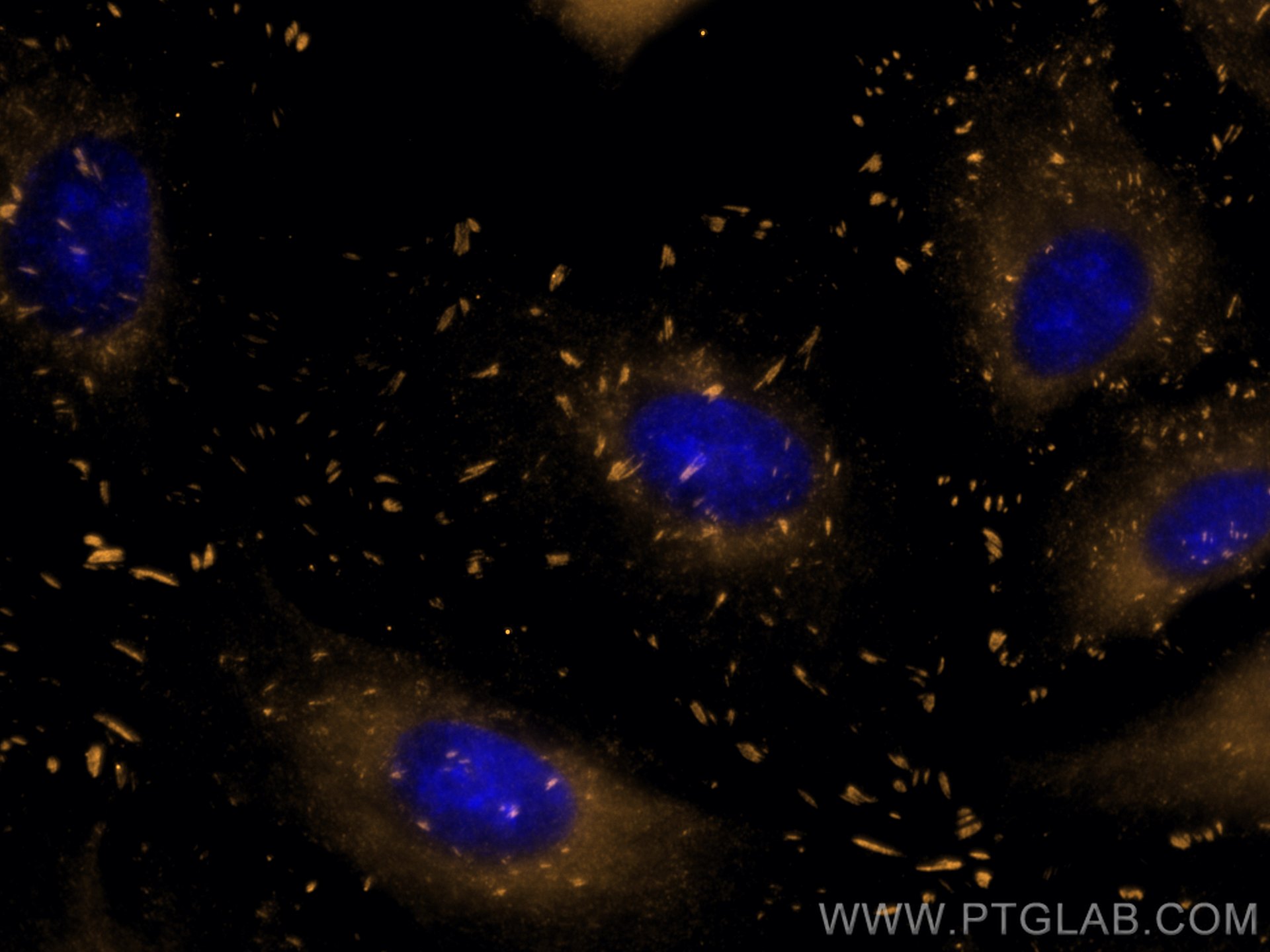 Immunofluorescence (IF) / fluorescent staining of A549 cells using CoraLite®555-conjugated FAK Monoclonal antibody (CL555-66258)