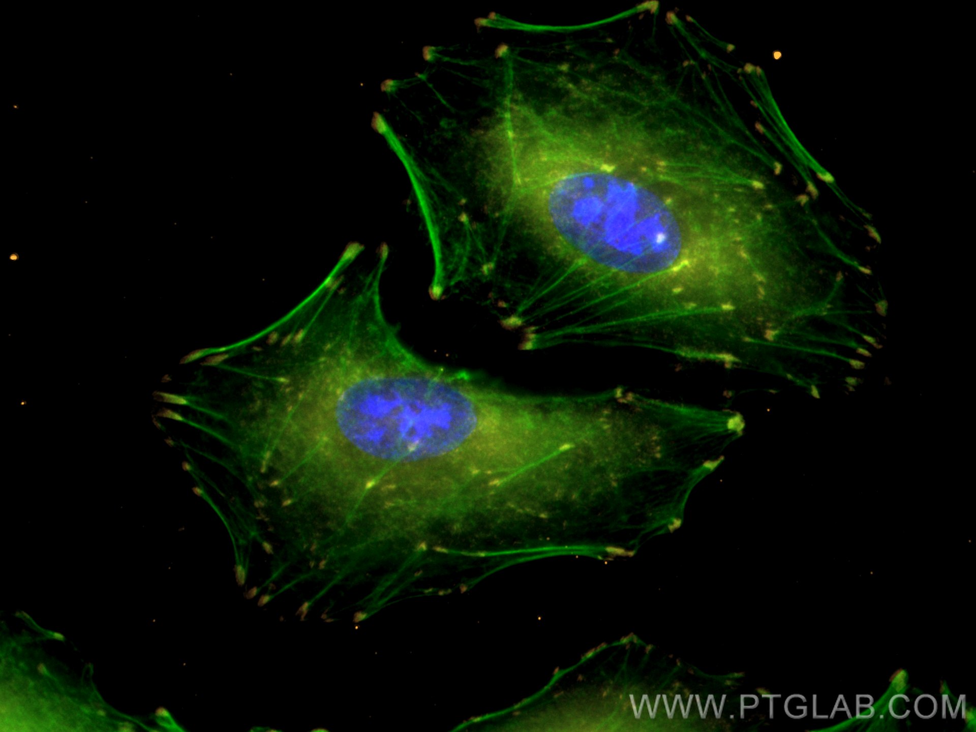 Immunofluorescence (IF) / fluorescent staining of A549 cells using CoraLite®555-conjugated FAK Monoclonal antibody (CL555-66258)