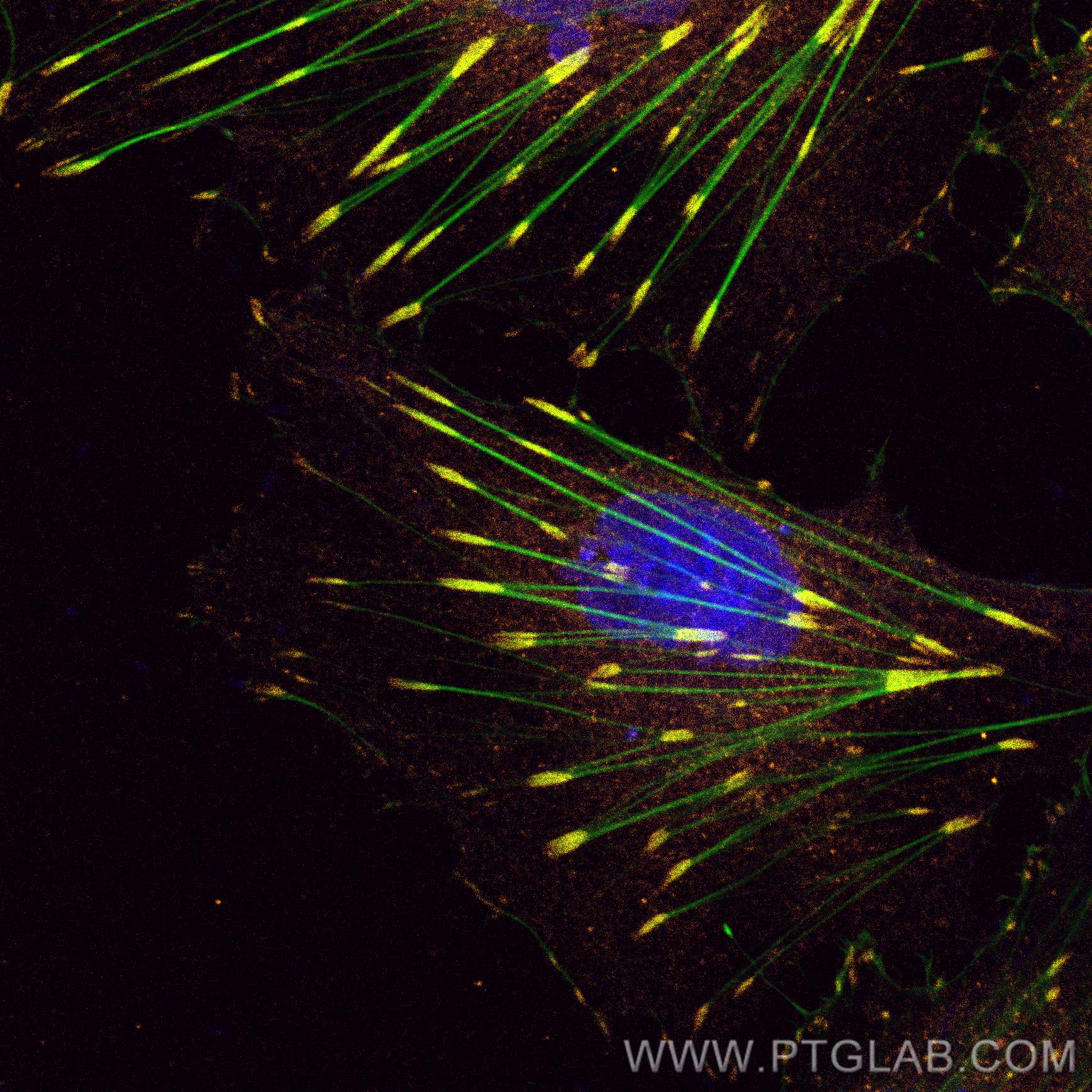 Immunofluorescence (IF) / fluorescent staining of HUVEC cells using CoraLite®555-conjugated FAK Monoclonal antibody (CL555-66258)