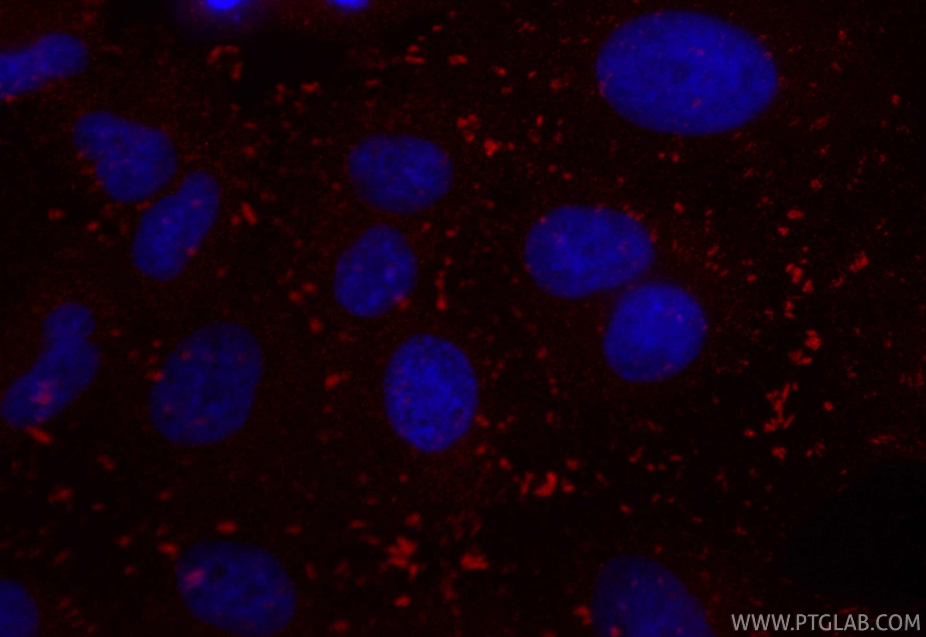 Immunofluorescent analysis of (4% PFA) fixed A549 cells using CoraLite®594 FAK antibody (CL594-81334-5, Clone: 242295E4 ) at dilution of 1:200. Immunofluorescence (IF) / fluorescent staining of A549 cells using CoraLite®594-conjugated FAK Recombinant monoclonal (CL594-81334-5)