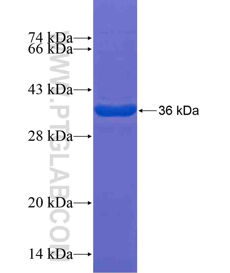 FAK fusion protein Ag17966 SDS-PAGE