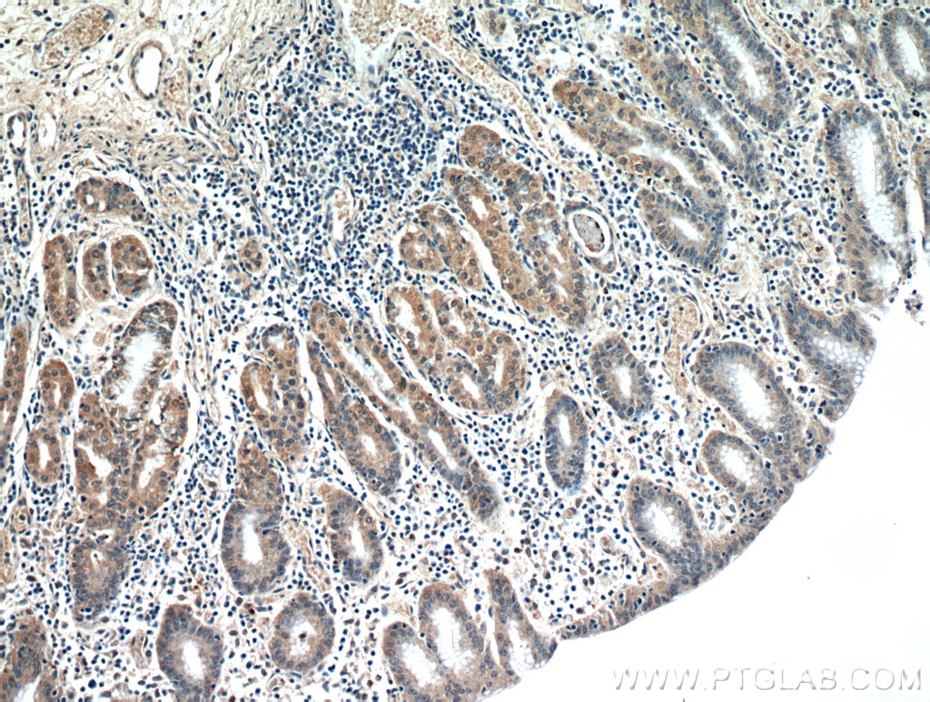 Immunohistochemistry (IHC) staining of human stomach tissue using FAM101A Polyclonal antibody (21113-1-AP)