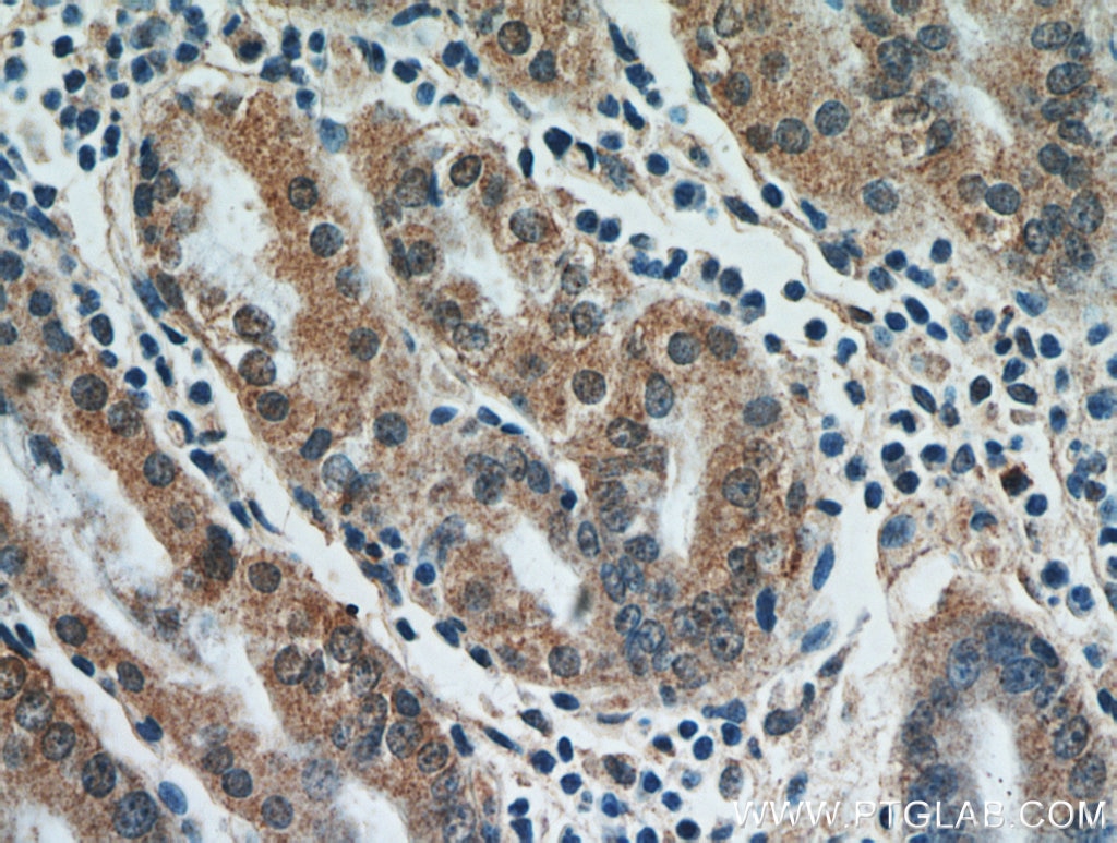 Immunohistochemistry (IHC) staining of human stomach tissue using FAM101A Polyclonal antibody (21113-1-AP)