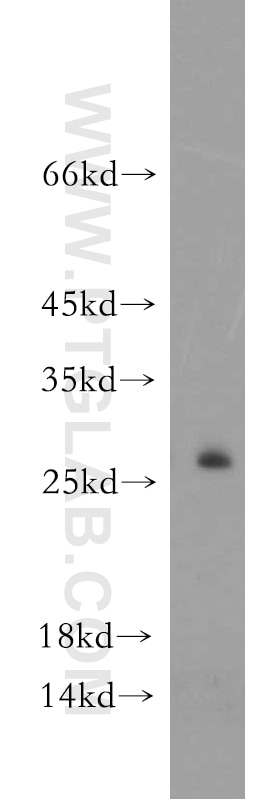 Western Blot (WB) analysis of HepG2 cells using FAM101A Polyclonal antibody (21113-1-AP)