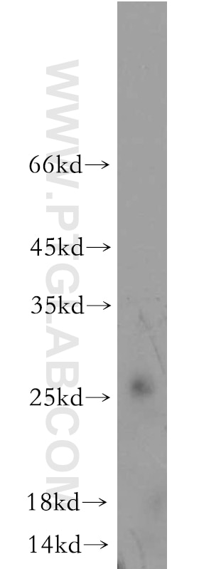 Western Blot (WB) analysis of human skeletal muscle tissue using FAM101A Polyclonal antibody (21113-1-AP)
