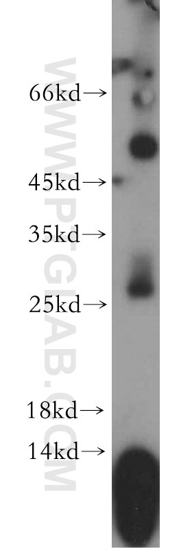 Western Blot (WB) analysis of mouse spleen tissue using FAM101A Polyclonal antibody (21113-1-AP)