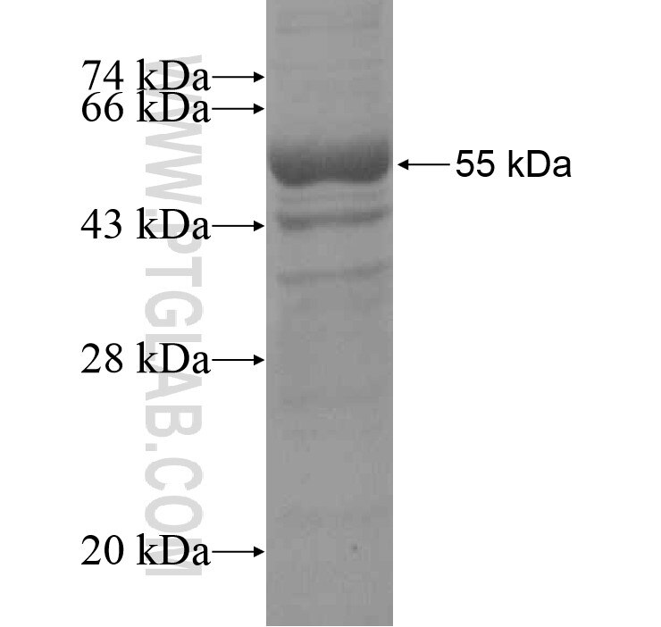 FAM101A fusion protein Ag15231 SDS-PAGE