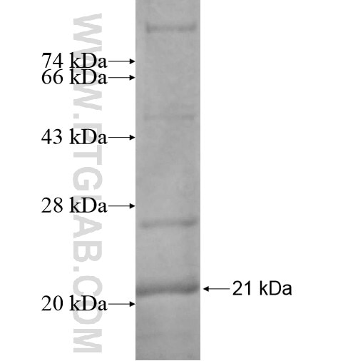 FAM101A fusion protein Ag15314 SDS-PAGE
