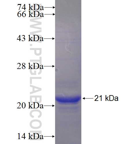 FAM101B fusion protein Ag23909 SDS-PAGE