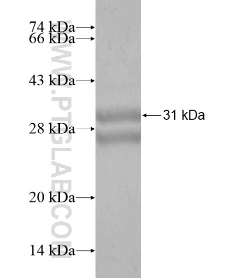 FAM102A fusion protein Ag20175 SDS-PAGE
