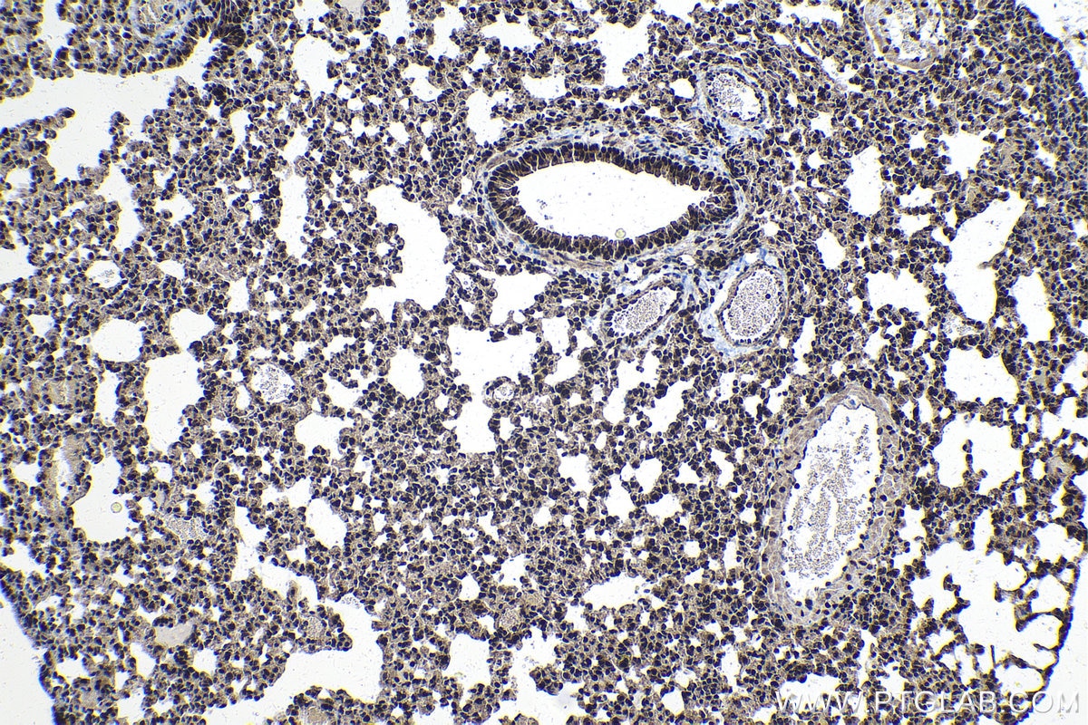 Immunohistochemistry (IHC) staining of mouse lung tissue using FAM103A1 Polyclonal antibody (19422-1-AP)