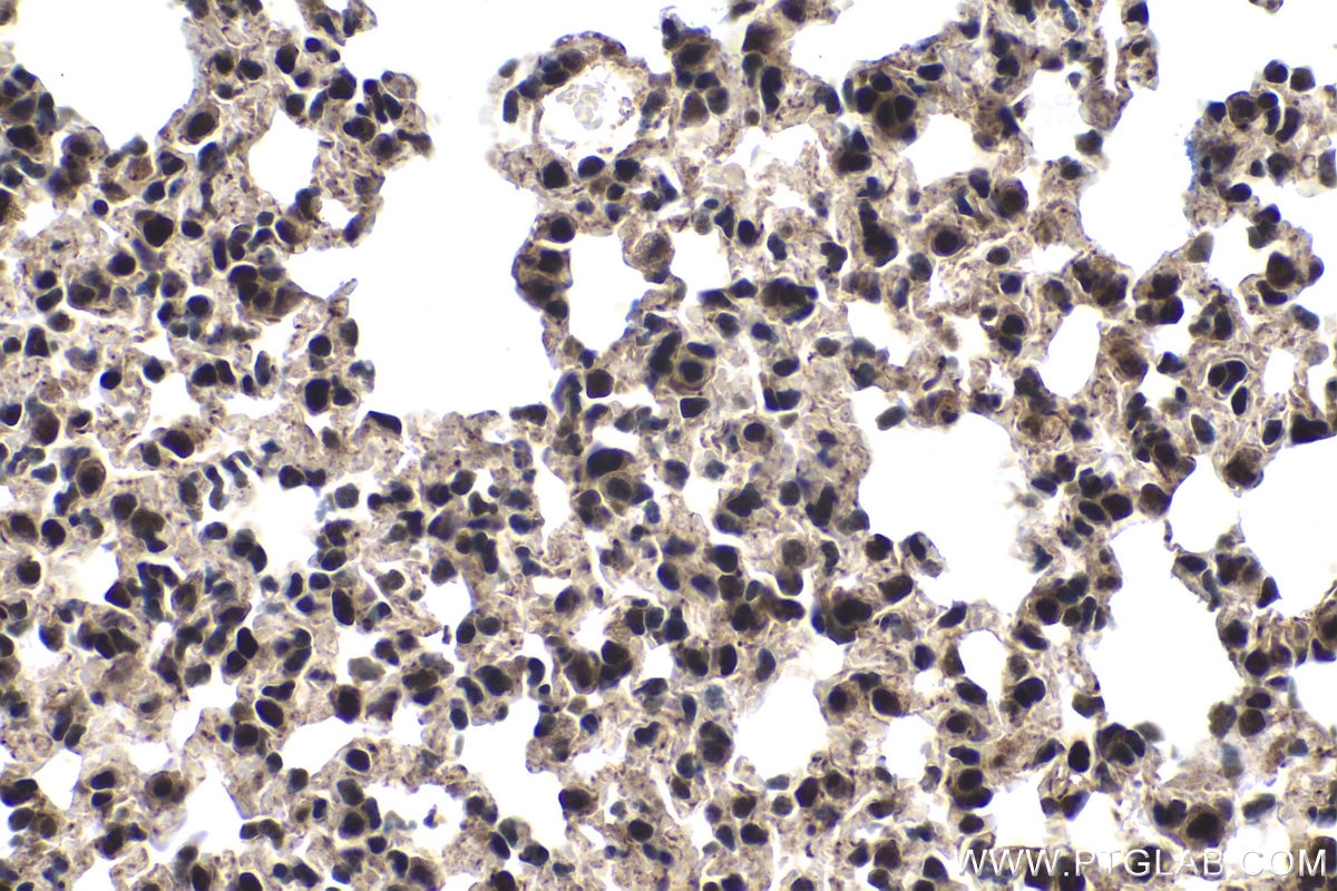 Immunohistochemistry (IHC) staining of mouse lung tissue using FAM103A1 Polyclonal antibody (19422-1-AP)
