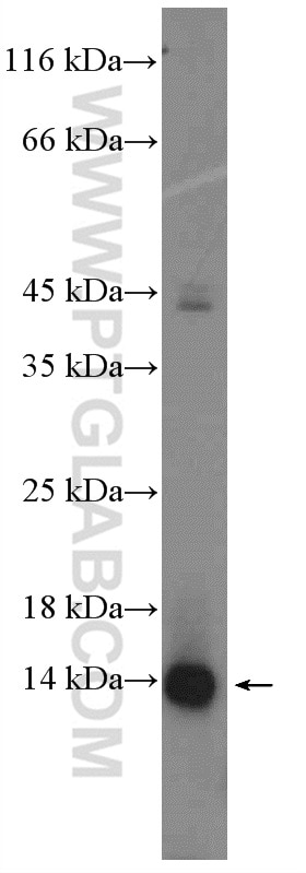 Western Blot (WB) analysis of A549 cells using FAM103A1 Polyclonal antibody (19422-1-AP)