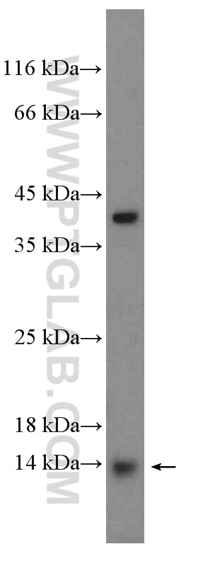 Western Blot (WB) analysis of PC-3 cells using FAM103A1 Polyclonal antibody (19422-1-AP)