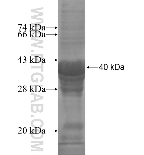 FAM103A1 fusion protein Ag13749 SDS-PAGE