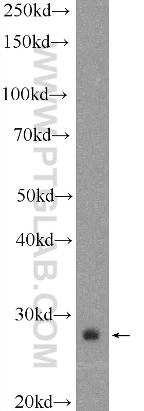 WB analysis of human placenta using 25668-1-AP