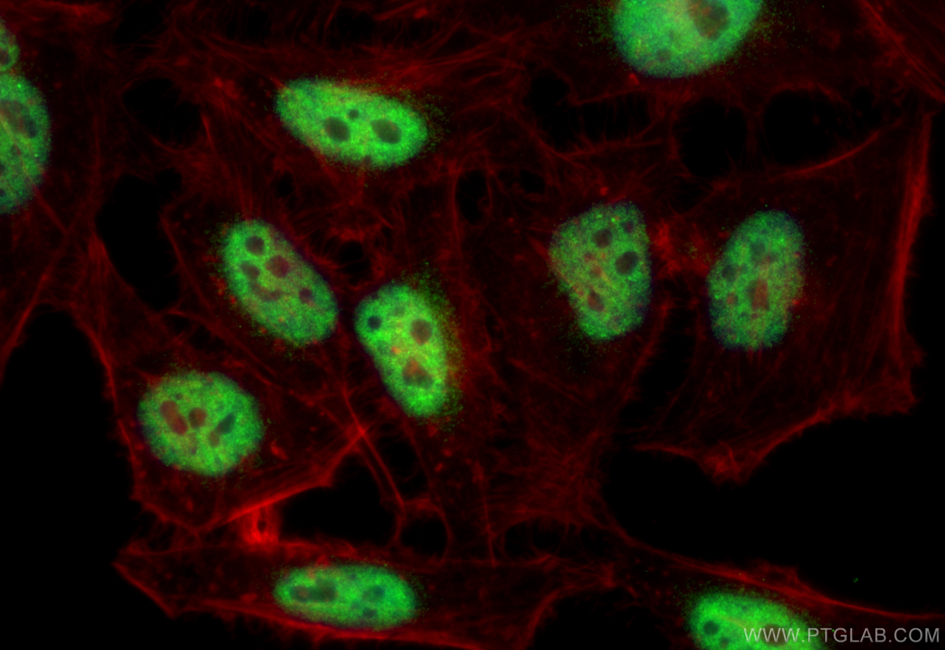 Immunofluorescence (IF) / fluorescent staining of HeLa cells using FAM107A Polyclonal antibody (12176-1-AP)