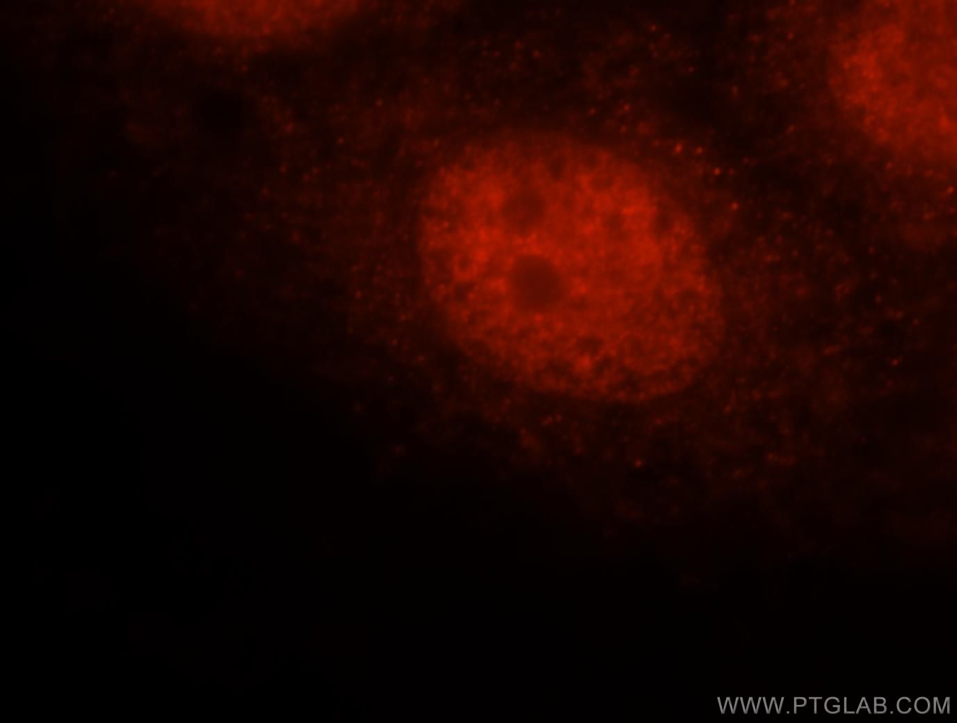 Immunofluorescence (IF) / fluorescent staining of MCF-7 cells using FAM107A Polyclonal antibody (12176-1-AP)