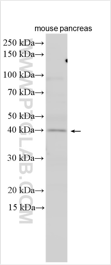Western Blot (WB) analysis of various lysates using FAM107B Polyclonal antibody (20527-1-AP)
