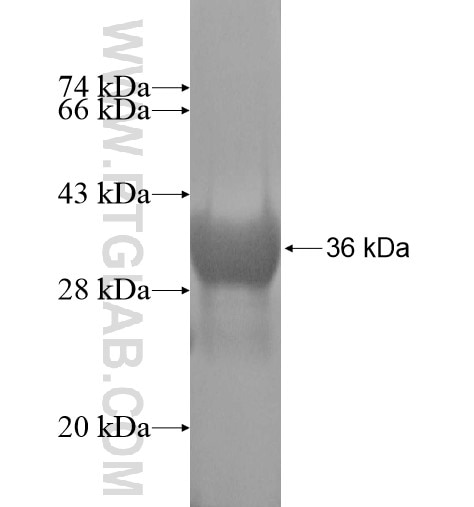 FAM107B fusion protein Ag14389 SDS-PAGE