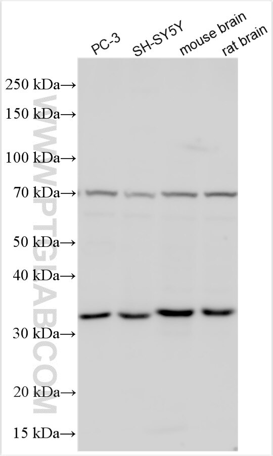 Western Blot (WB) analysis of various lysates using ABHD17A Polyclonal antibody (15854-1-AP)