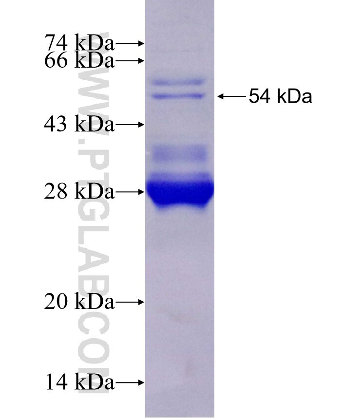 FAM111B fusion protein Ag29376 SDS-PAGE
