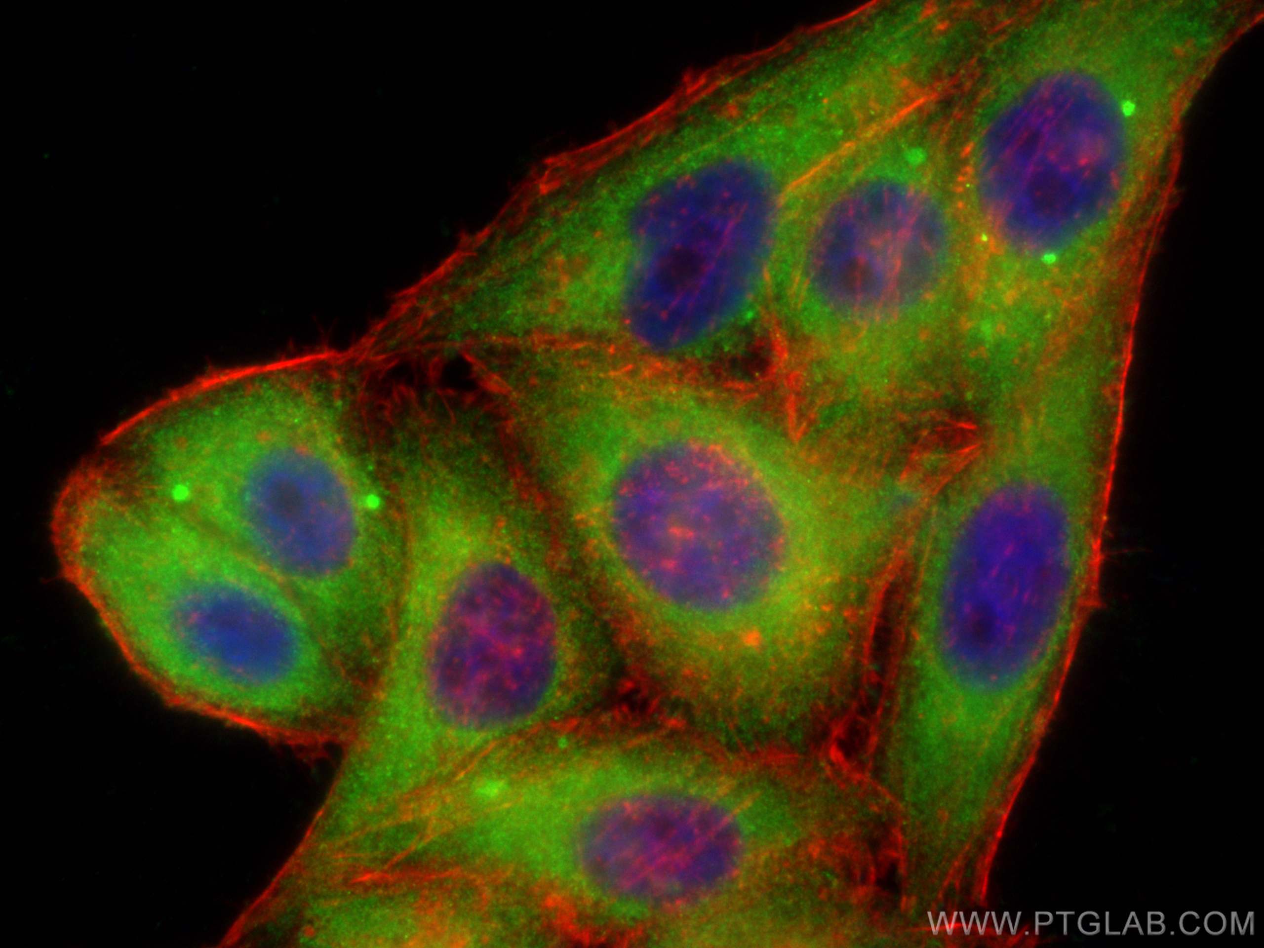 IF Staining of HepG2 using 21638-1-AP