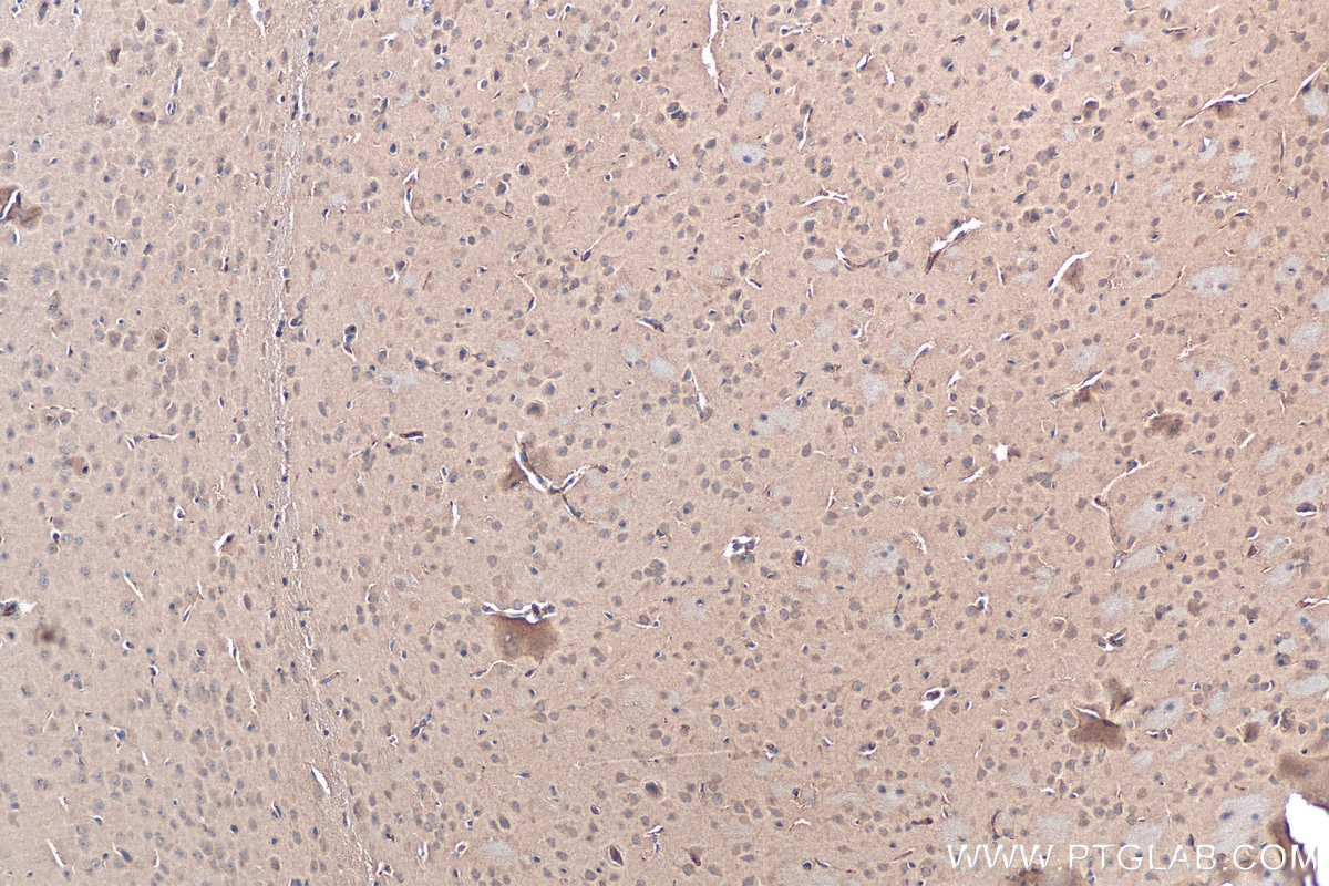 Immunohistochemistry (IHC) staining of mouse brain tissue using FAM114A1 Polyclonal antibody (21638-1-AP)