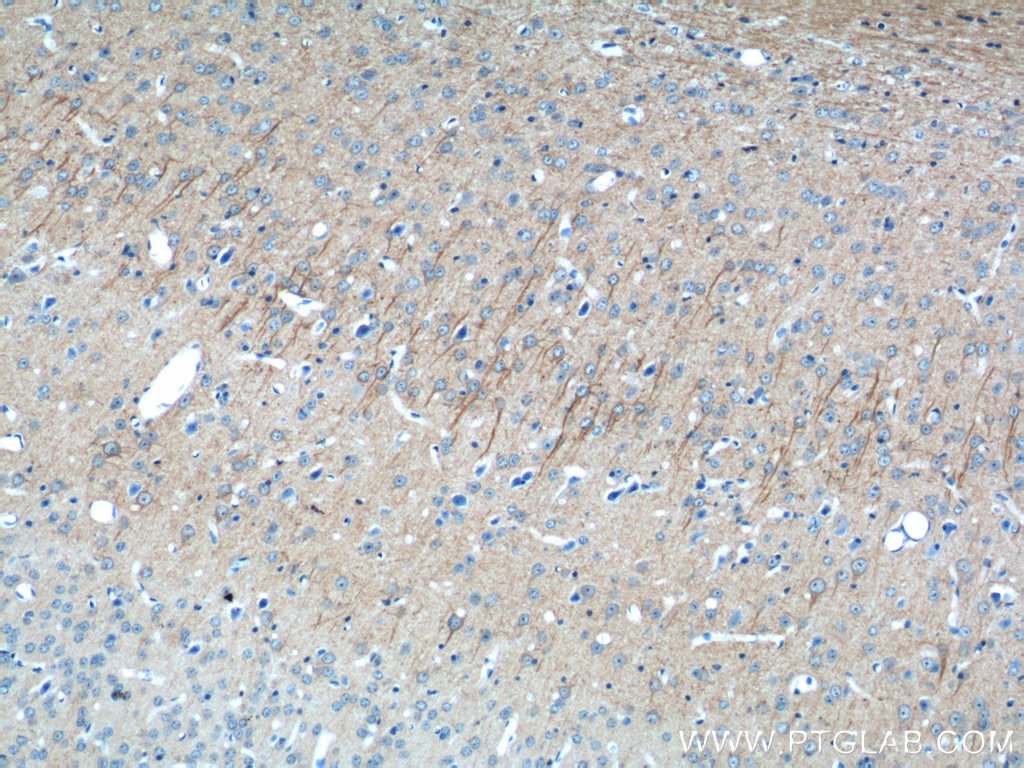 Immunohistochemistry (IHC) staining of mouse brain tissue using FAM114A1 Polyclonal antibody (21638-1-AP)