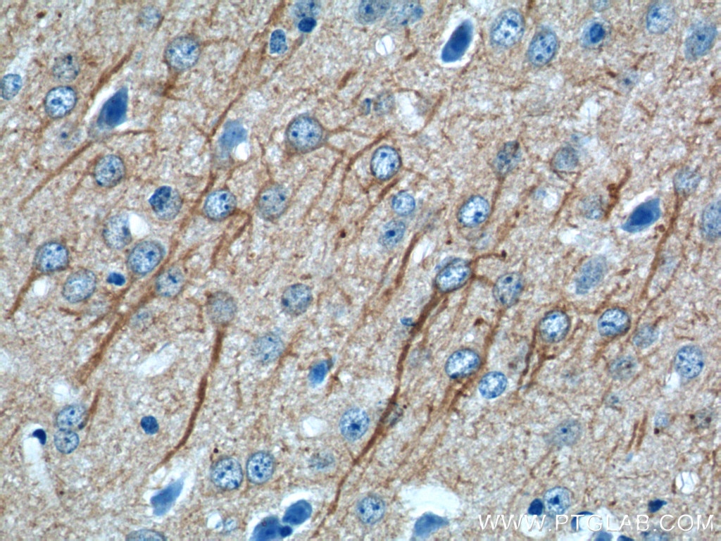 Immunohistochemistry (IHC) staining of mouse brain tissue using FAM114A1 Polyclonal antibody (21638-1-AP)