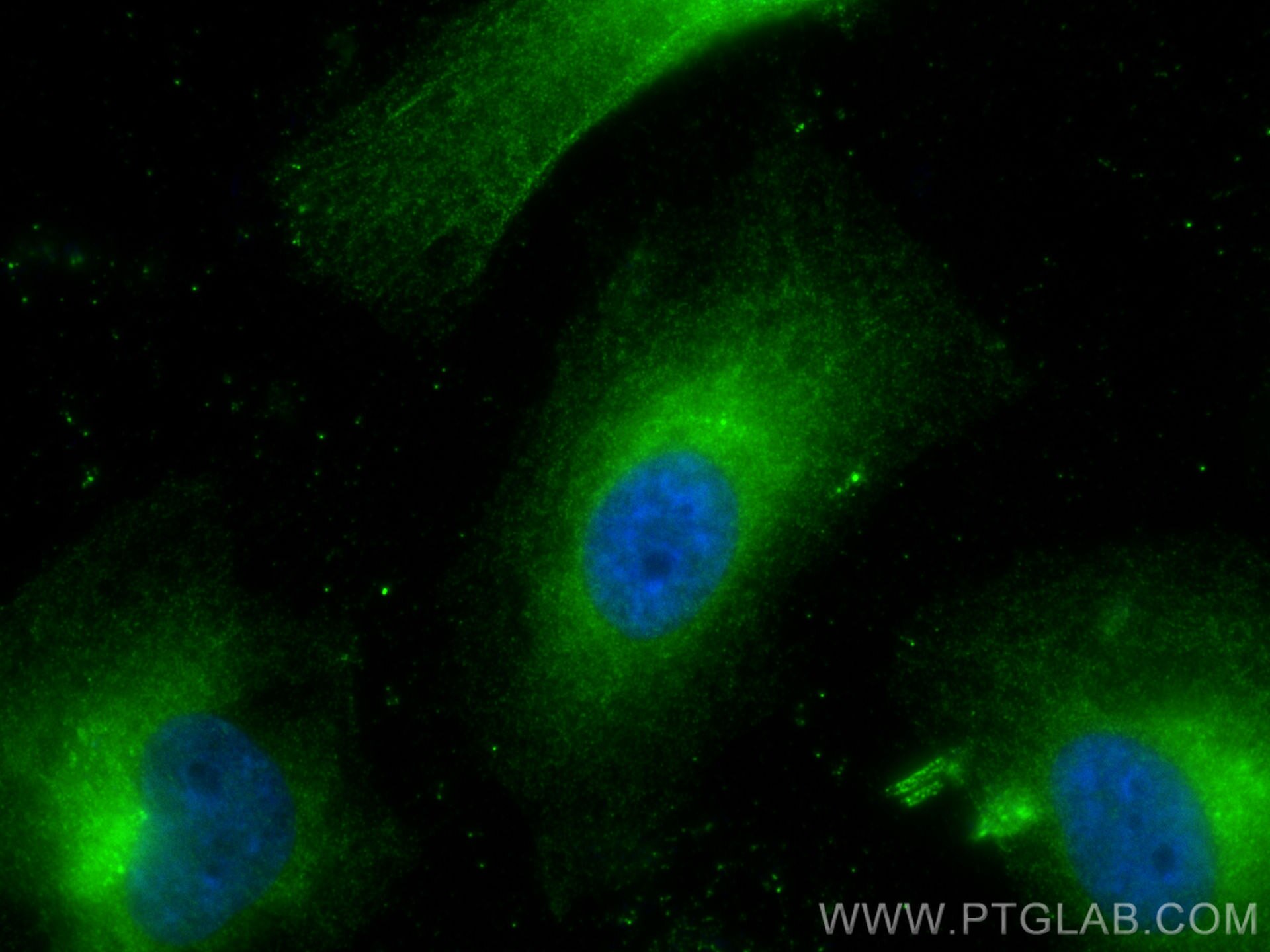 Immunofluorescence (IF) / fluorescent staining of HeLa cells using FAM114A2 Polyclonal antibody (29917-1-AP)