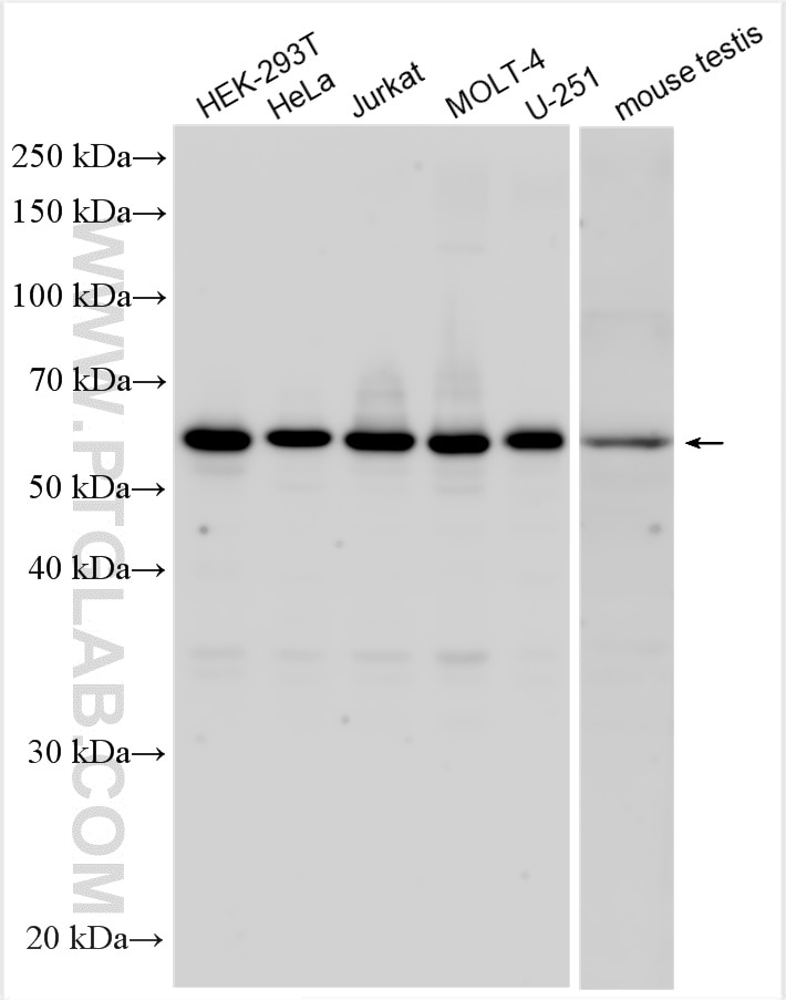 Western Blot (WB) analysis of various lysates using FAM114A2 Polyclonal antibody (29917-1-AP)