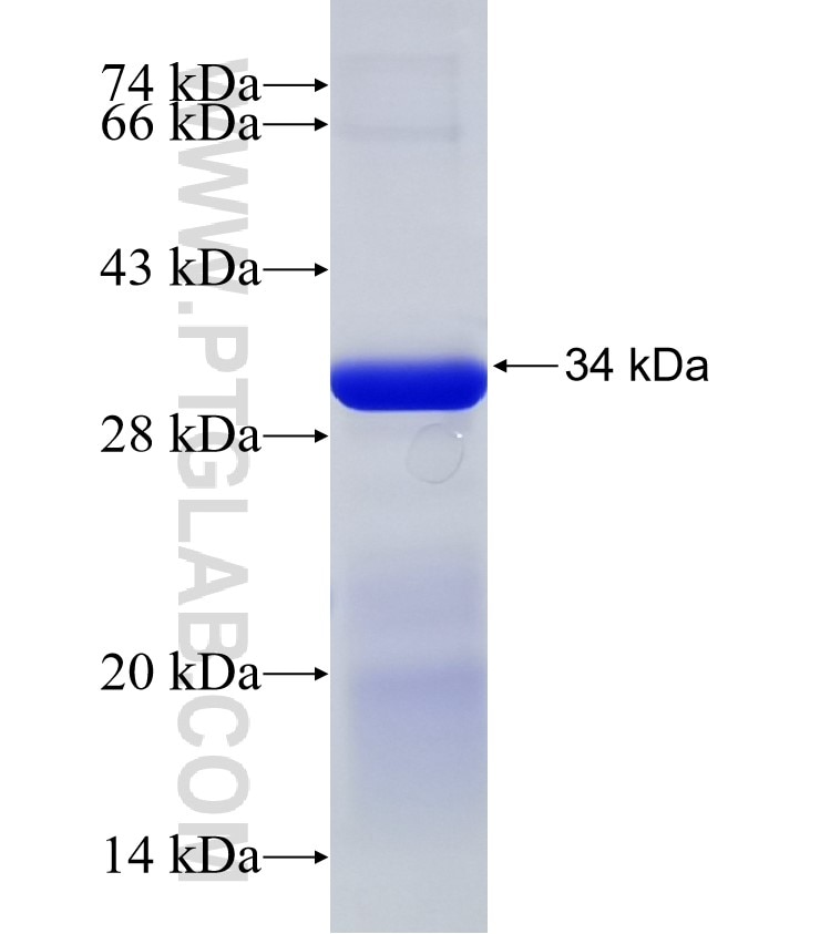 FAM114A2 fusion protein Ag31981 SDS-PAGE FAM114A2 fusion protein Ag31981 SDS-PAGE