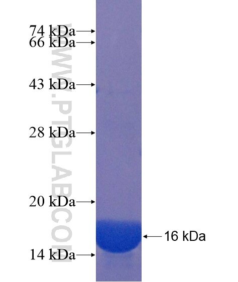 FAM116A fusion protein Ag22006 SDS-PAGE FAM116A fusion protein Ag22006 SDS-PAGE