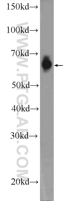 Western Blot (WB) analysis of A549 cells using FAM116B Polyclonal antibody (26024-1-AP)