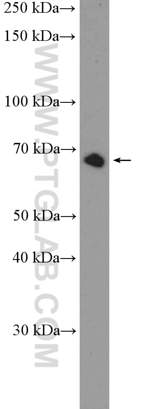 Western Blot (WB) analysis of HeLa cells using FAM116B Polyclonal antibody (26024-1-AP)