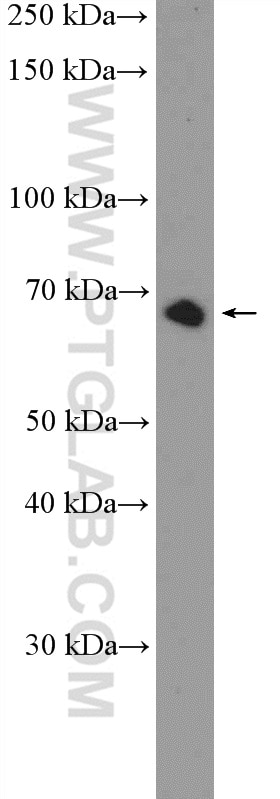 WB analysis of HeLa using 26024-1-AP